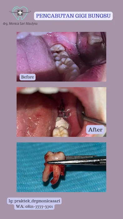 Modera Dental by drg Monica Sari Maulyna Picture 7